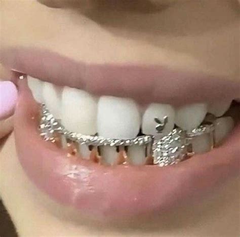 Pin by слава on скайсы | Teeth jewelry, Diamond teeth, Tooth gem
