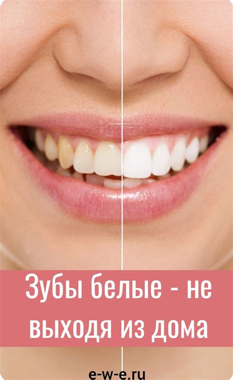 Когда вы встречаете кого-то в первый раз и видите белоснежные зубы, это ...