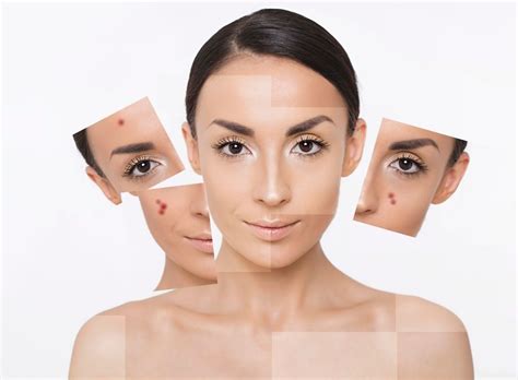 Dermatološki pregled - Poliklinika Petković