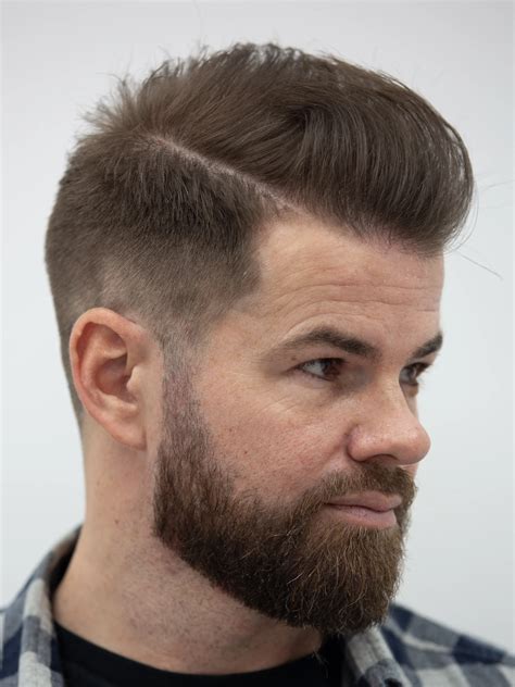 how long does a hair transplant last 1