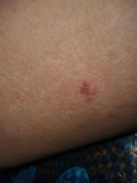 kulit badan hellosehat