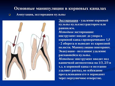 Эндодонтия. Принципы обработки полости зубов и каналов корней ...