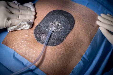 Wound Care Institute – Advanced wound care made simple…