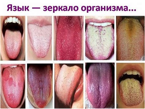 Отек, опухоль и припухлость языка: причины, что делать, если он распух ...