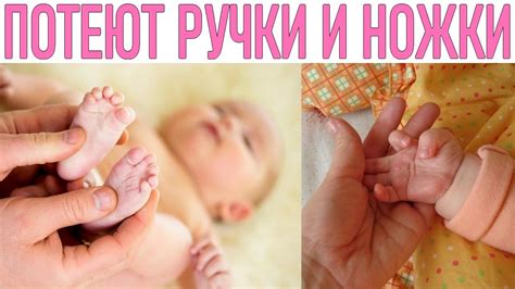 У РЕБЕНКА ПОТЕЮТ РУКИ И НОГИ | Что делать если у ребёнка потеют руки и ...