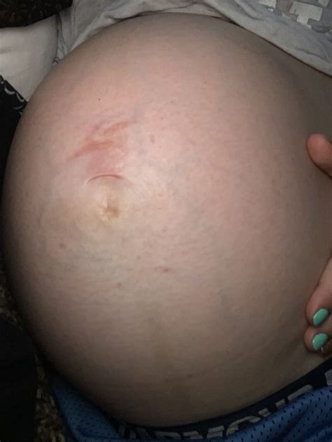 Belly Button Piercing Pregnancy Stretch