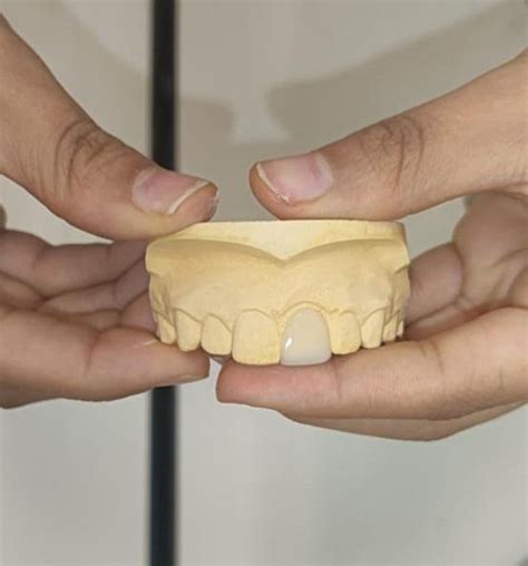 CARILLA DENTAL