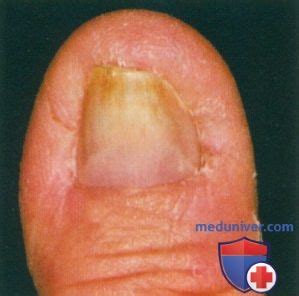 Серия фотографий №4: экстремальные случаи из подологической практики