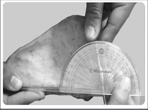 measurement  lateral angle  scientific diagram