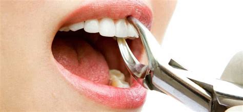 Using Best Pain Relief for Toothache | Wisdom Tooth Pain Relief