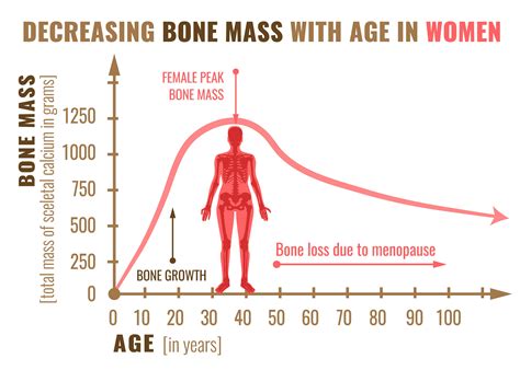 Decrease the Risk of Osteoporosis with Exercise - Propel Physiotherapy