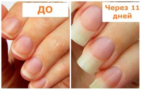 здоровье | Прочные ногти, Отращивать длинные ногти, Отращивание ногтей
