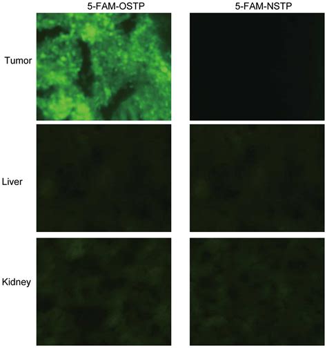 OSTP as a novel peptide specifically targeting human ovarian cancer