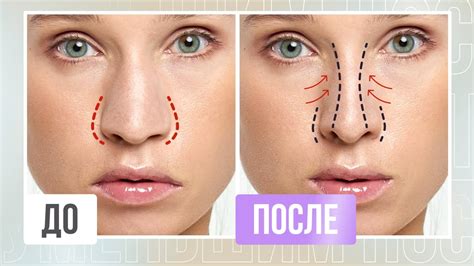 УМЕНЬШАЕМ НОС без ОПЕРАЦИЙ | Как изменить форму носа без ринопластики в ...