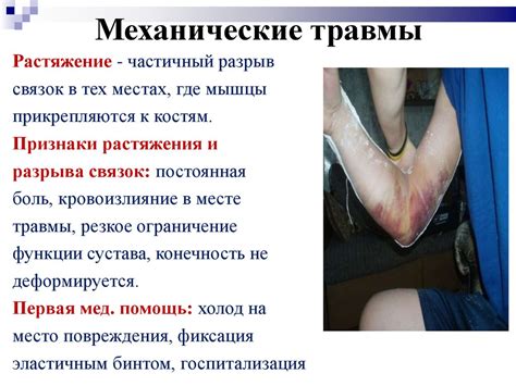 Травмы, виды травм. Первая медицинская помощь при различных видах травм ...