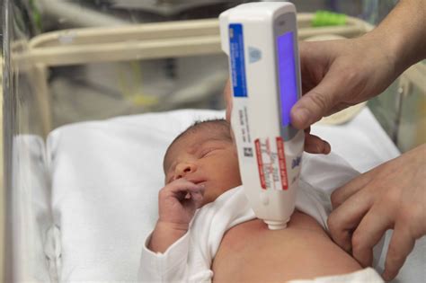 painless testing  walsall babies walsall healthcare nhs trust