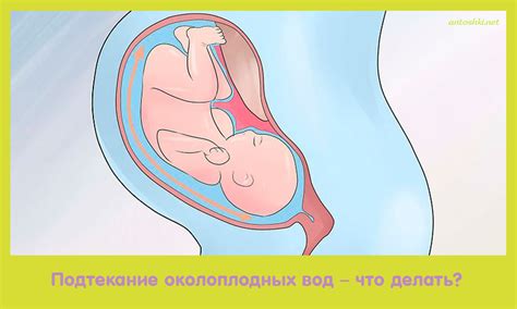 Подтекание околоплодных вод – что делать?