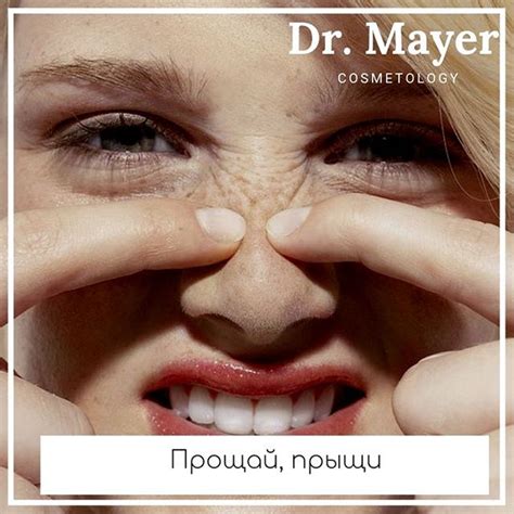 Как отмечают косметологи проблема акне перестала быть исключительно ...