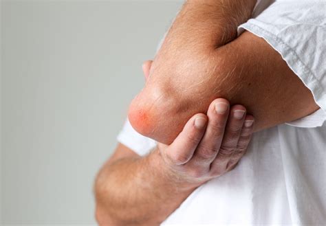 What Does Elbow Bursitis Look & Feel Like? | Philadelphia Hand to Shoulder