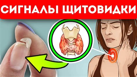 СРОЧНО! Это признаки того, что щитовидка больна - YouTube