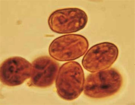 Giardia – Lex