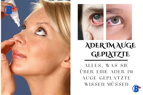 Ader Im Auge Geplatzt: Ursachen, Risiken Und Der Augenarzt-Tipp