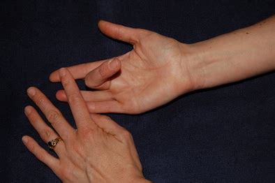 PIP Joint Exercises – Hand Therapy Group