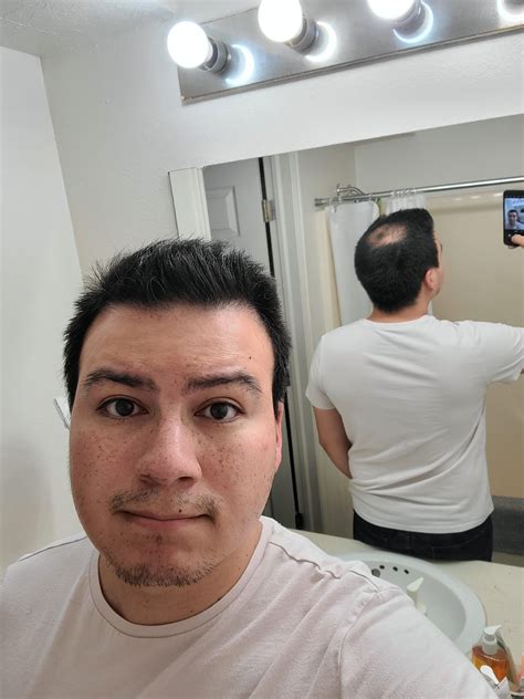 Is it time? Or do I have a bit longer? : r/bald