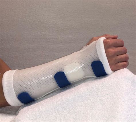 thermoplastic splint custom  thermoplastic light weight