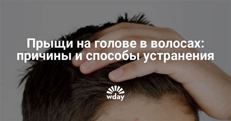 Прыщи на голове в волосах у мужчин, причины — www.wday.ru | WDAY