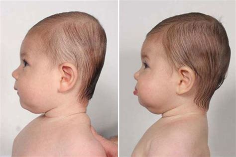 Da Baby Head Shape - The Ins And Outs Of Flat Head Syndrome In Babies | Giblrisbox Wallpaper