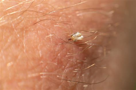 bee stinging stock  images  backgrounds