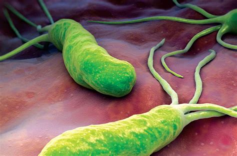 Helicobacter Pylori (bacteria en el estómago): Causas, síntomas y ...