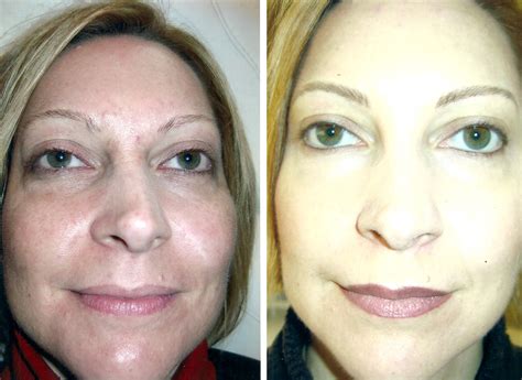 Full Face Permanent Makeup | Permanent Makeup By Rosie Wells