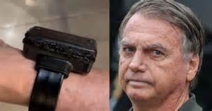 O Que Tinha Dentro Da Tornozeleira Do Bolsonaro