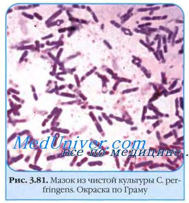 Возбудитель газовой гангрены. Газовая гангрена. Clostridium perfringens ...