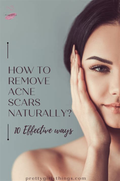 How To Remove Acne Scars Naturally: 10 Effective Home Remedies ...