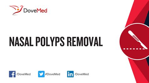 Nasal Polyps Removal