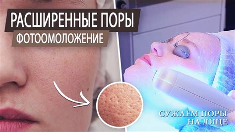 Как сузить поры на лице. Уход за проблемной кожей. Чистка лица ...