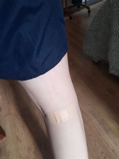 Stranger provides plaster after fish bite. - Time for Kindness