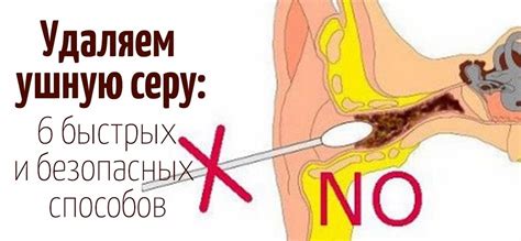 Ушная сера — это вещество, которое находится во внутреннем ухе и ...
