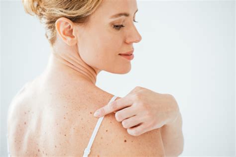 7 Symptoms For Skin Cancer That May Surprise You