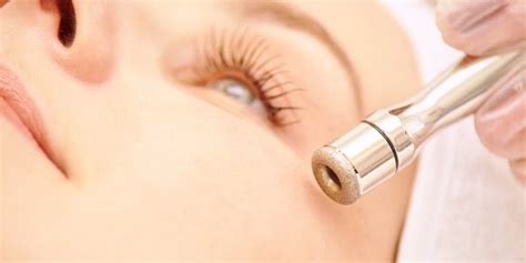 Diamond Dermabrasion - Cinderella Beauty