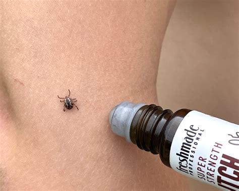 Itch Stop - Freshmade Professional