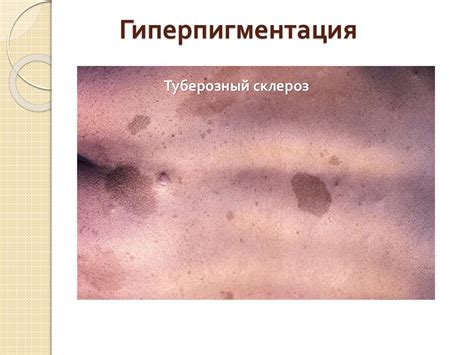 Первичные бесполостные морфологические признаки кожи - online presentation