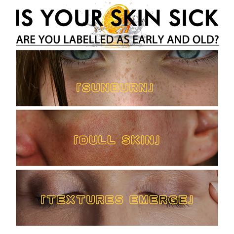 how to treat dark spots on face 4