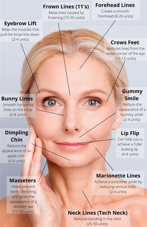 botox injections salt lake city ut dysport park city ut