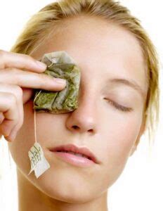 Swollen Eyelid Home Remedies, Cure Upper and Lower Swollen Eyelids ...