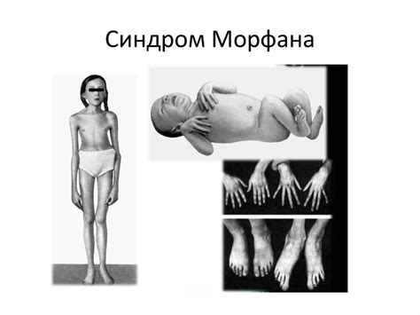 Демографический взрыв. Генетический груз. Теории уничтожения ...