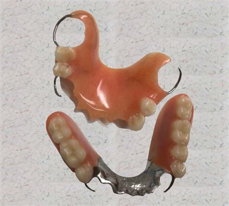 partial denture  image partial dentures meaning chax